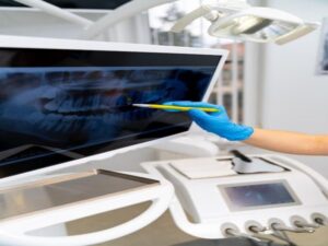Advanced X-ray detector portfolio