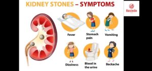 causes of kidney stones